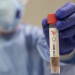 Coronavirus, a Varese si sperimenta un test rapido