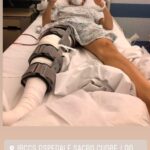 repossi operazione ginocchio